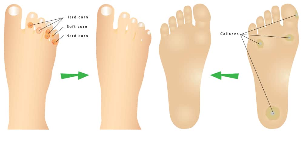 Foot Health Complete Birkenstock